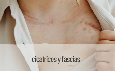 cicatrices y fascias