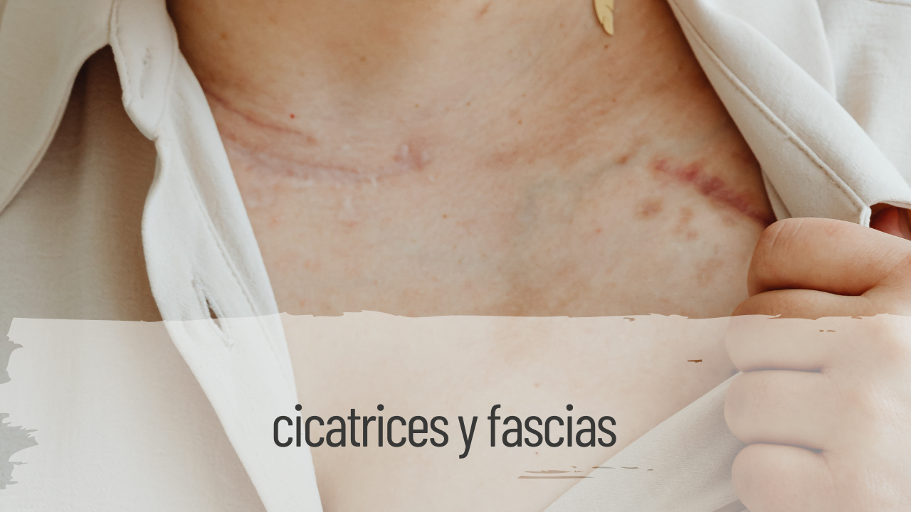 cicatrices y fascias